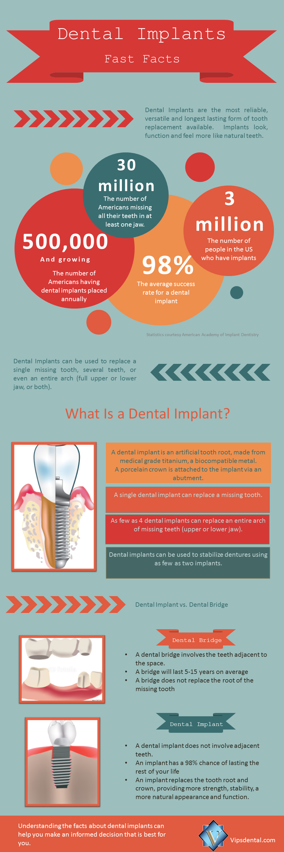 dental implant infographic